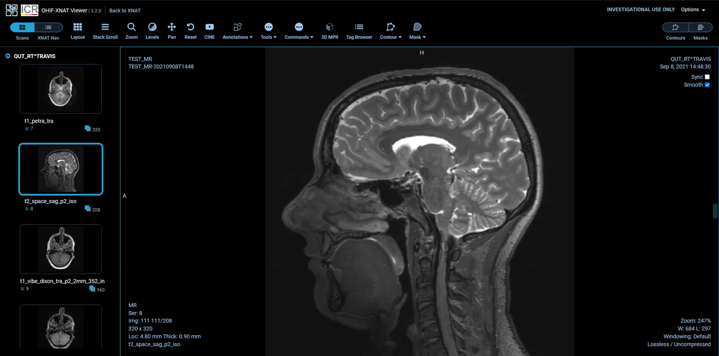 OHIF viewer